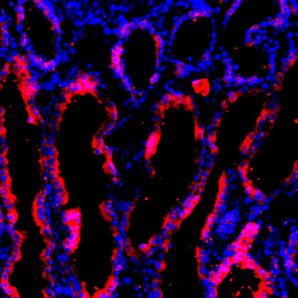 Крупным планом показаны человеческие клетки (красные) в выращенной свиньей человеческой почке.